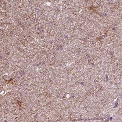 Immunohistochemistry-Paraffin: shootin-1 Antibody [NBP2-38374]