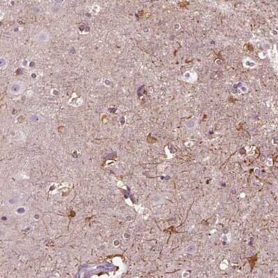 Immunohistochemistry-Paraffin: shootin-1 Antibody [NBP2-38374]