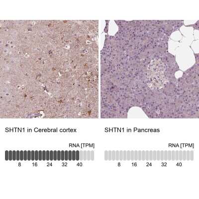 Immunohistochemistry-Paraffin: shootin-1 Antibody [NBP2-38374]
