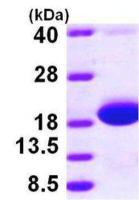 Western Blot: Recombinant E. coli skp His Protein [NBP1-46052]