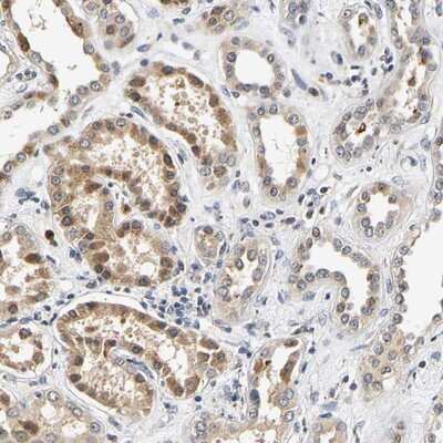 Immunohistochemistry-Paraffin: smu1 Antibody [NBP1-88521]