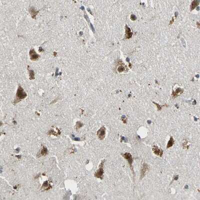 Immunohistochemistry-Paraffin: smu1 Antibody [NBP1-88522]