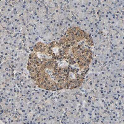 Immunohistochemistry-Paraffin: smu1 Antibody [NBP1-88522]