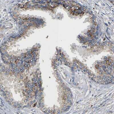 Immunohistochemistry-Paraffin: smu1 Antibody [NBP1-88522]