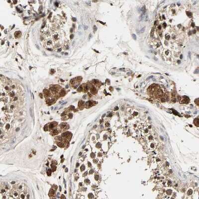 Immunohistochemistry-Paraffin: smu1 Antibody [NBP1-88522]