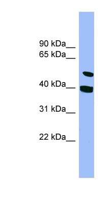 Western Blot: smu1 Antibody [NBP1-56881]