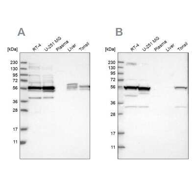 Western Blot: smu1 Antibody [NBP1-88521]