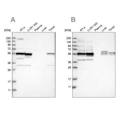 Western Blot: smu1 Antibody [NBP1-88522]