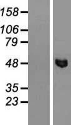 Western Blot: smu1 Overexpression Lysate [NBL1-16258]