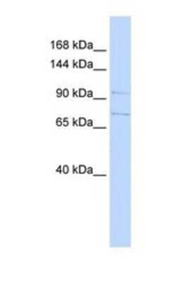 Western Blot: SLC8A3/NCX3 Antibody [NBP1-69515]