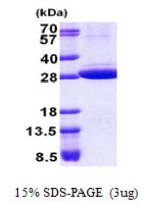 SDS-PAGE: Recombinant Human Stomatin His Protein [NBP2-22833]