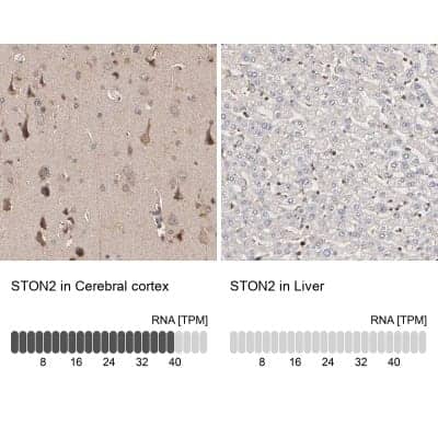 Immunohistochemistry-Paraffin: stonin-2 Antibody [NBP1-90658]