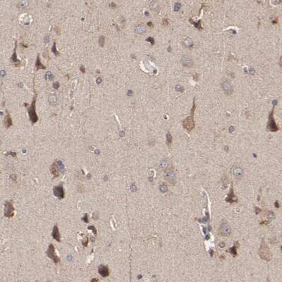 Immunohistochemistry-Paraffin: stonin-2 Antibody [NBP1-90658]