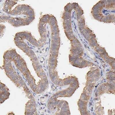 Immunohistochemistry-Paraffin: stonin-2 Antibody [NBP1-90658]