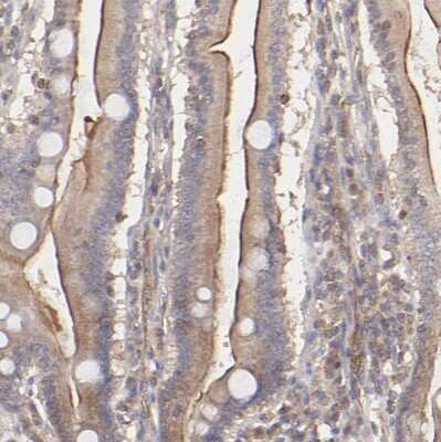 Immunohistochemistry-Paraffin: stonin-2 Antibody [NBP1-90658]