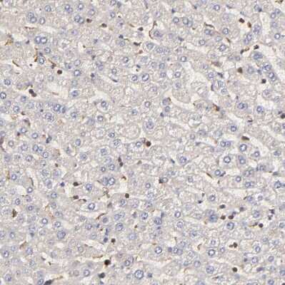 Immunohistochemistry-Paraffin: stonin-2 Antibody [NBP1-90658]