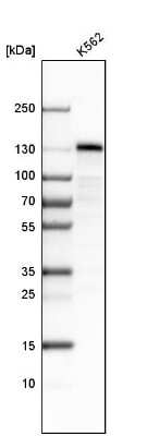 Western Blot: stonin-2 Antibody [NBP1-90658]