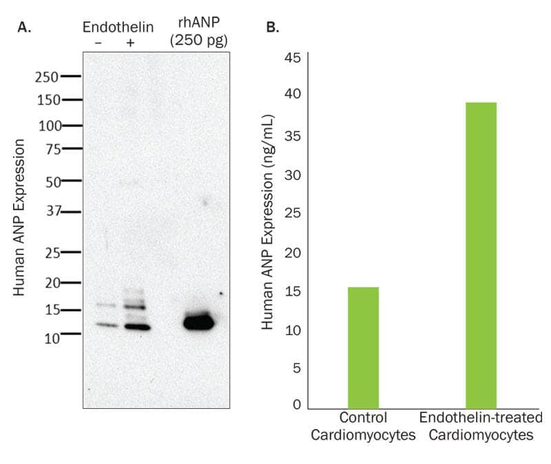 western blot and ELISA ANP expression in cardiomyocytes derived from iPSCs