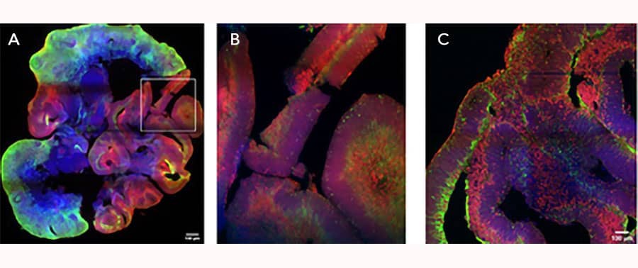iPSC-derived cerebral organoids