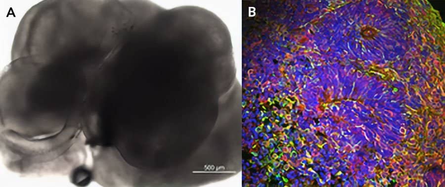 iPSC-derived cerebral organoids