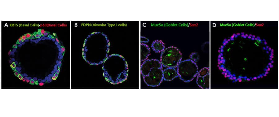 Adult Stem Cell-derived Lung Organoids