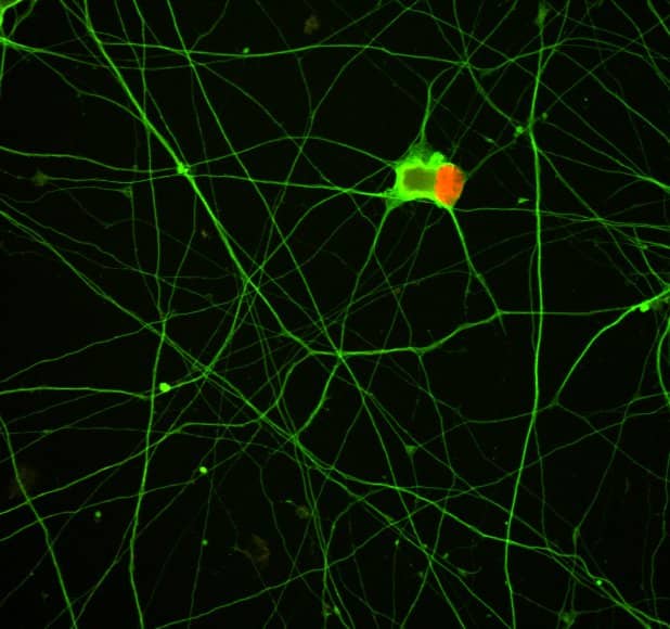 Application of LDN 193189 in motor neurons differentiated from iPSCs