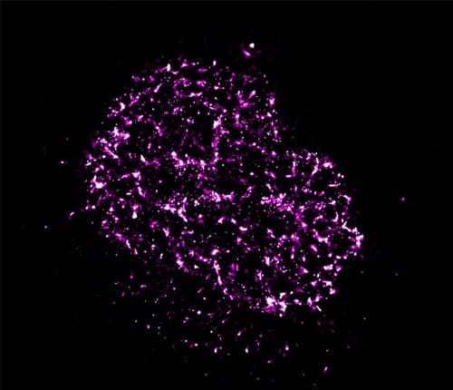 Super-resolution imaging of methylated histones (H3K9me3) in a COS-7 cell line