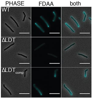 Investigating mycobacteria cell wall formation using FDAA HADA.