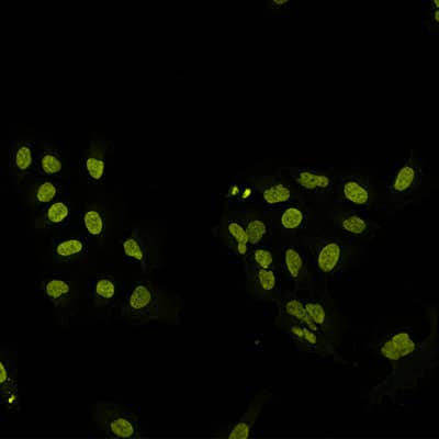 Application of Hoechst Janelia Fluor&#174; 526 in U2OS cells.