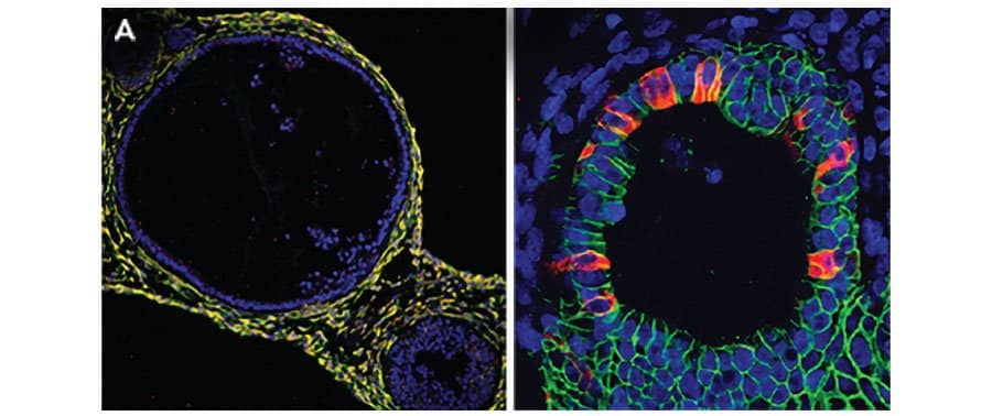 iPSC-derived Human Intestinal Organoid
