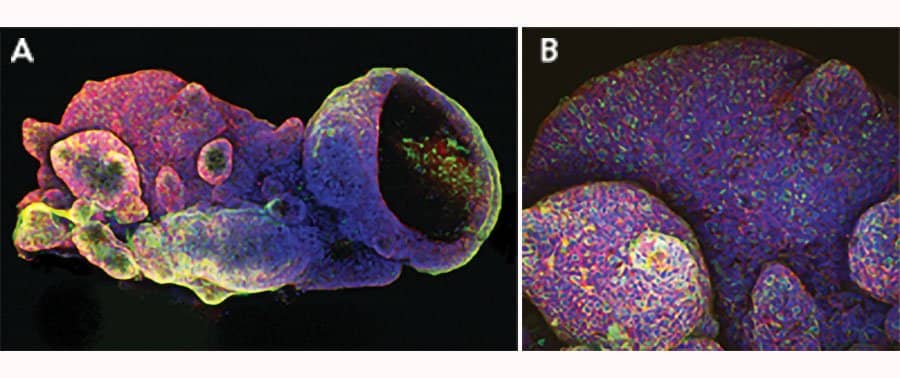 Adult Stem Cell-derived Human Descending Colon Organoids