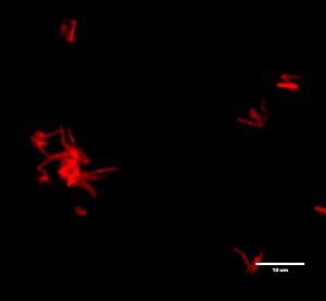 Far-red fluorogenic trehalose probe for live mycobacteria imaging
