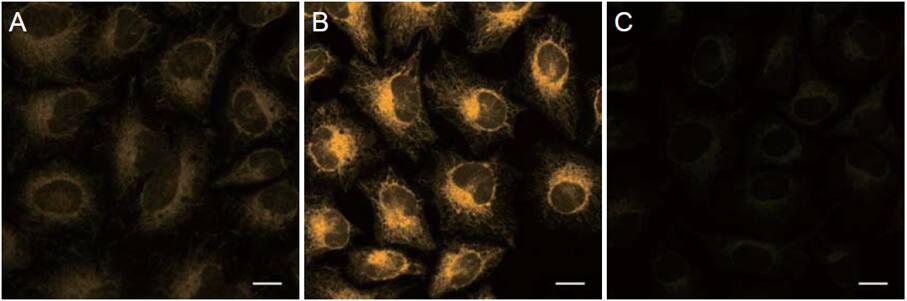Application of FerroOrange in HeLa cells