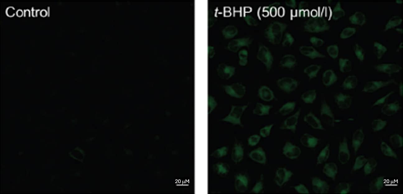 Fluorescence images of lipid peroxidation in HeLa cells