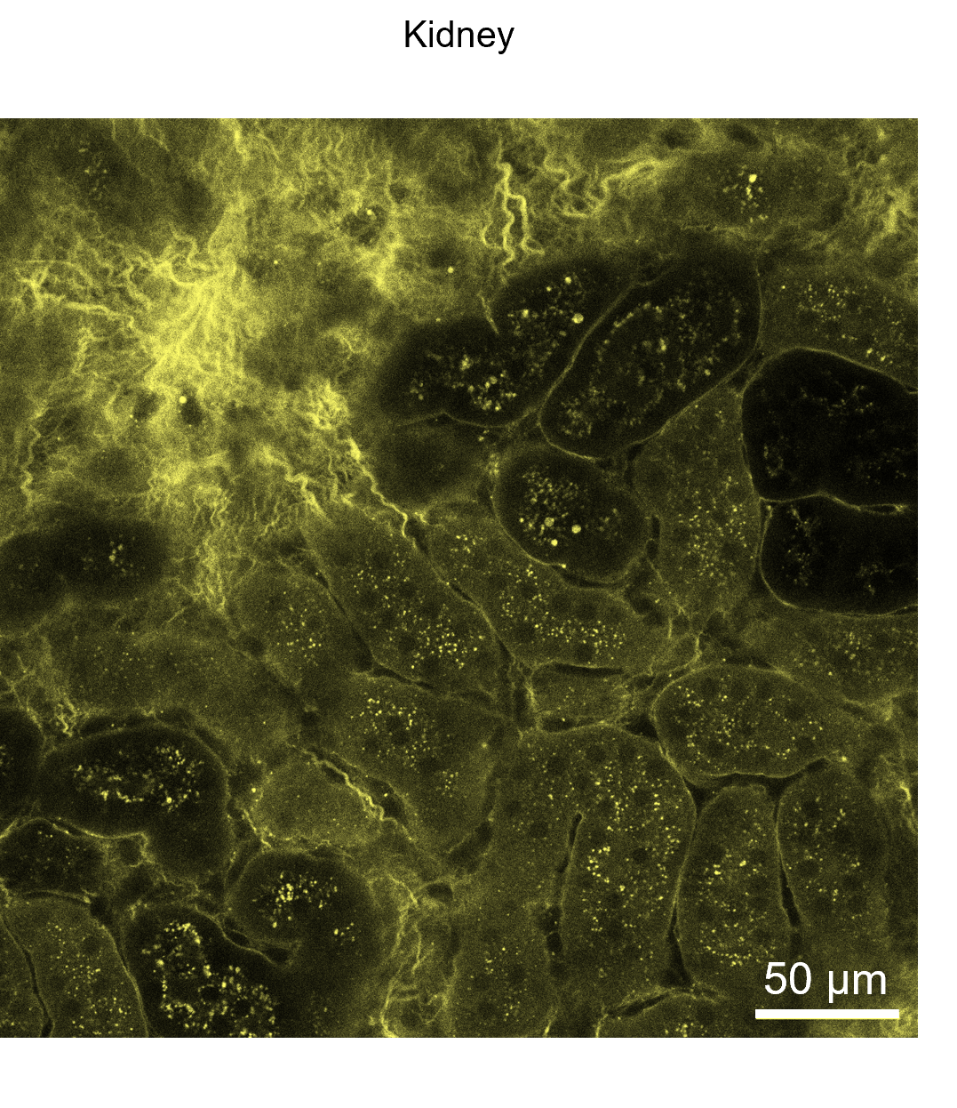 Use of Rhobo6 ECM Dye for labeling the extracellular matrix (ECM) in live kidney tissues.
