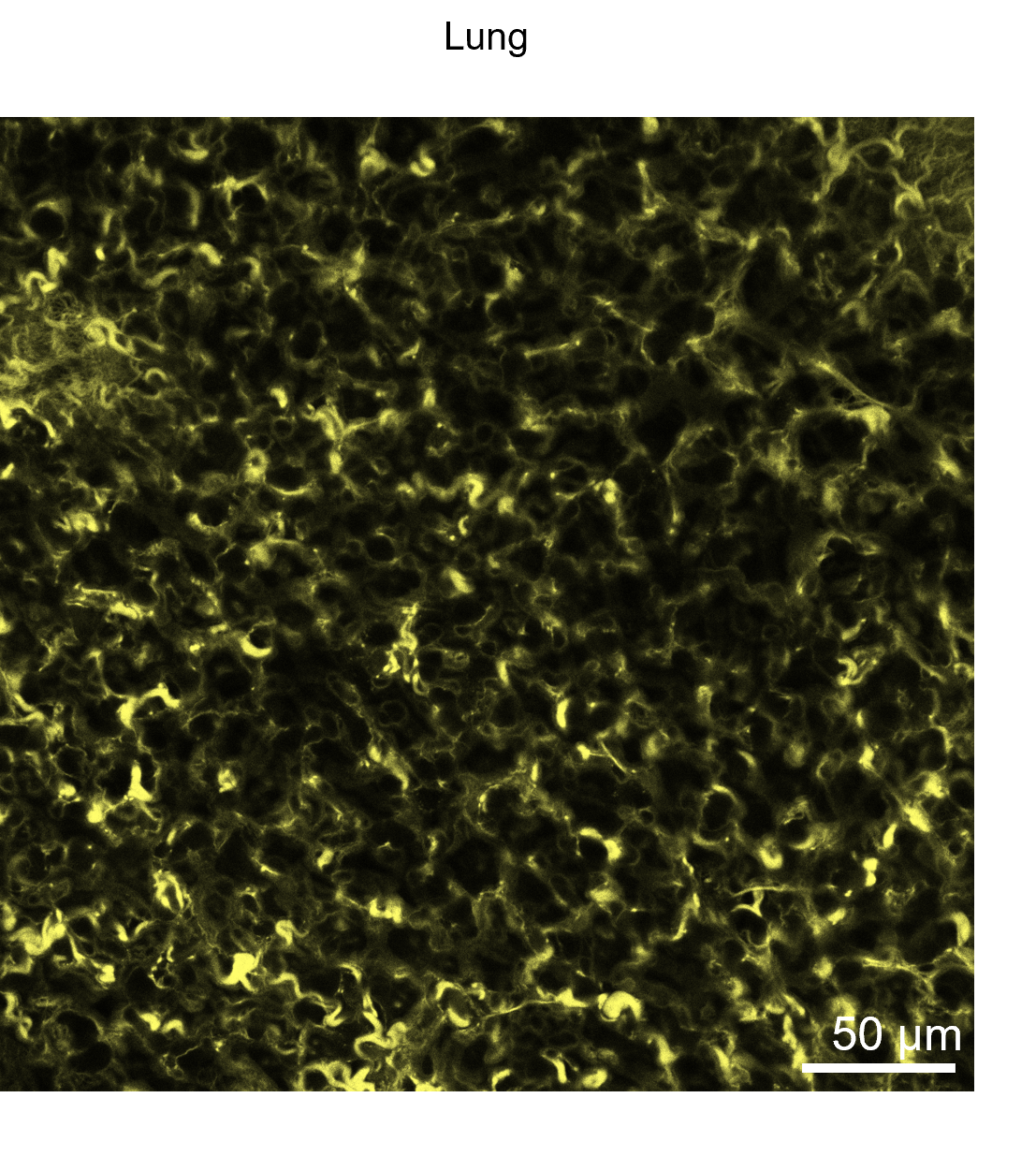 Use of Rhobo6 ECM Dye for labeling the extracellular matrix (ECM) in live lung tissues.