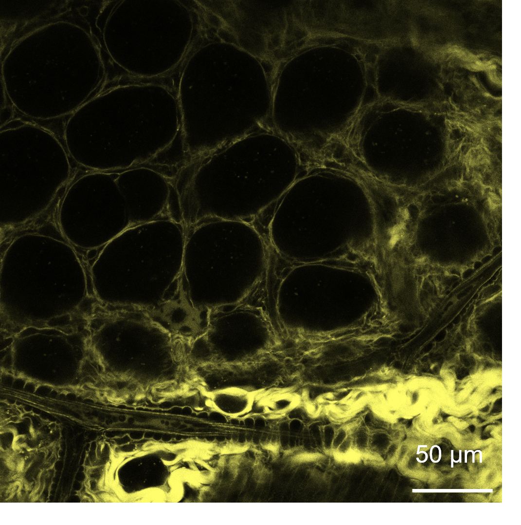Use of Rhobo6 ECM Dye for labeling the extracellular matrix (ECM) in live small intestine tissues.