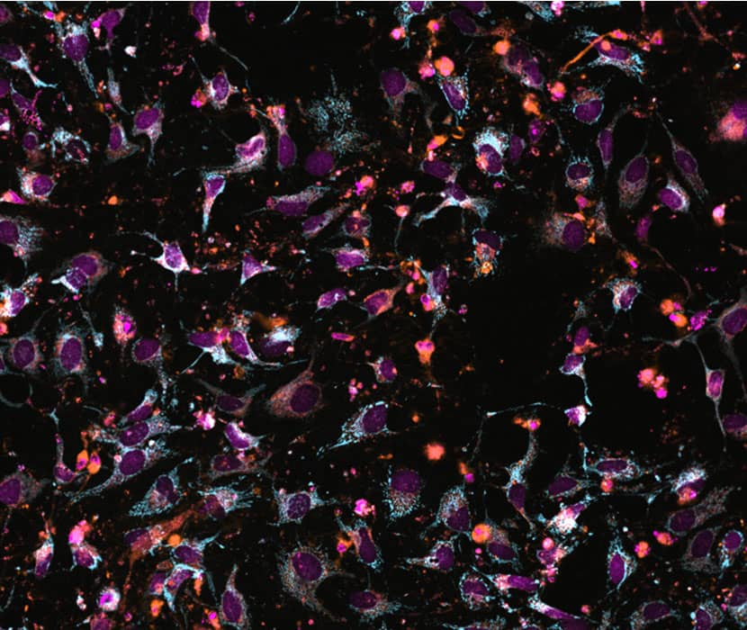 Ready-to-use fluorescent probe for long term high content phenotypic screening of live cells