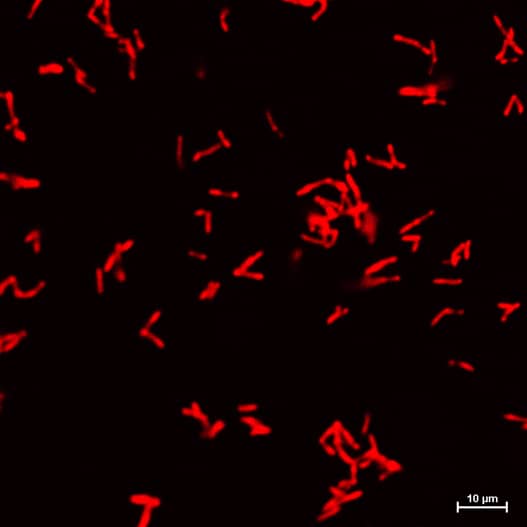 Application of Janelia Fluor®646 Tre for live bacterial imaging