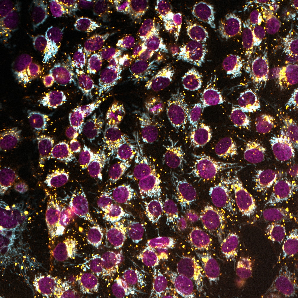 ChromaLIVE™ Deep Red Non-Toxic Dye High-Content Imaging