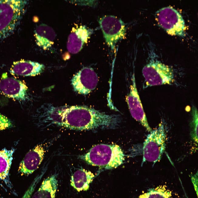 Multiplexed Phenotypic Imaging with ChromaLIVE™ Deep Red Non-toxic Dye and ER-LIVE™ Endoplasmic Reticulum Dye