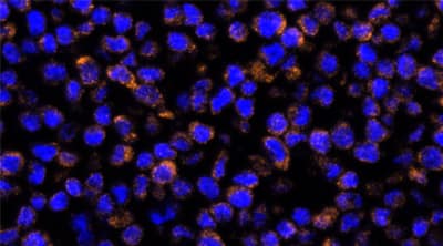 ClariTSA™ Fluorophore Kit 620 image