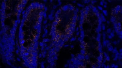 ClariTSA™ Fluorophore Kit 620 image
