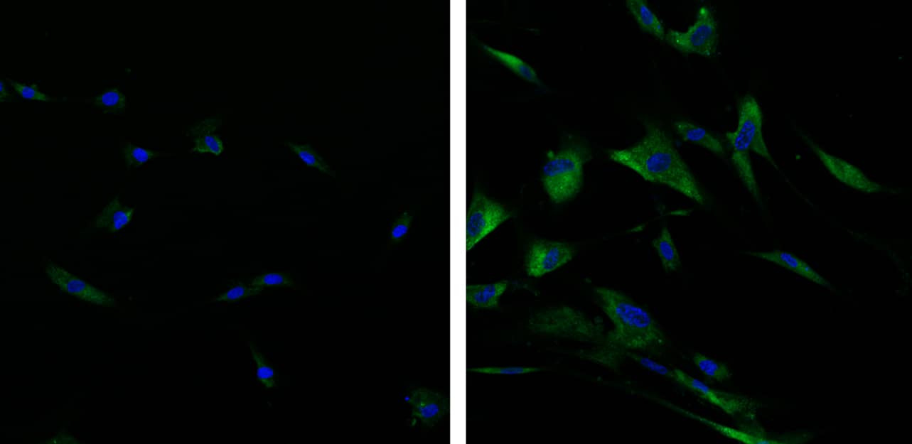Detection of senescence-associated  beta -galactosidase (SA-beta -gal) activity using SPiDER-beta Gal