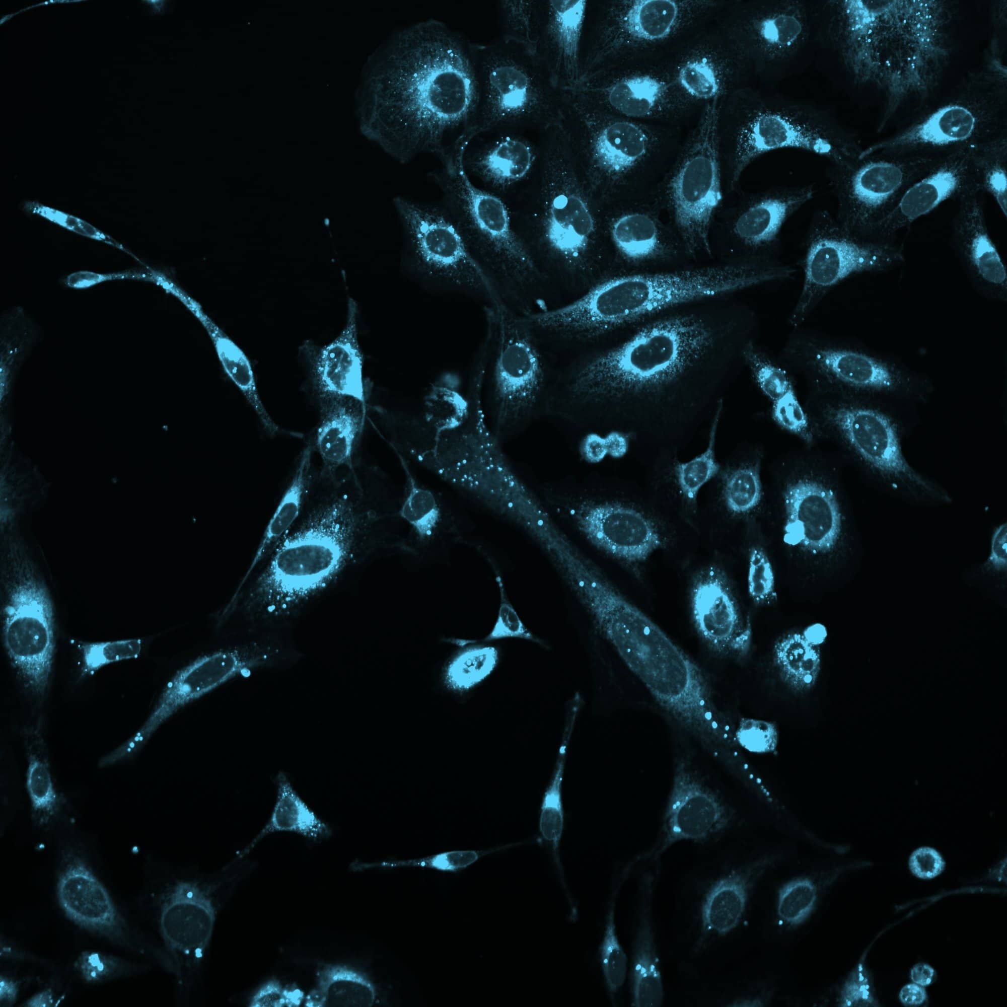 Image of U2OS cells stained with LipoLIVE™ Deep Red showing staining of