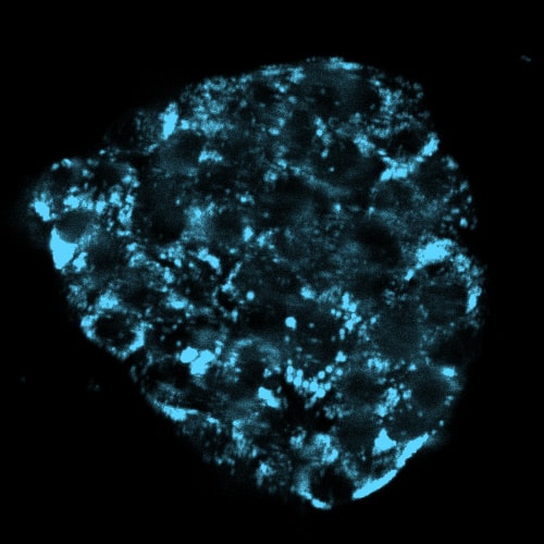 Images of Hep G2 cells stained with LipoLIVE™ Deep Red for 24h before overnight incubation with 100uM Oleic Acid