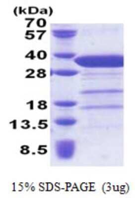 SDS-PAGE: Recombinant Human Syntaxin 6 His Protein [NBP2-22844]