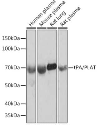 Western Blot: t-Plasminogen Activator/tPA Antibody (10W4L1) [NBP3-16356]