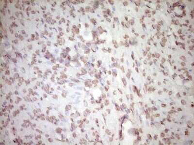Immunohistochemistry-Paraffin: t-Plasminogen Activator/tPA Antibody (OTI3H3) [NBP2-46435]