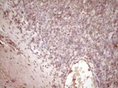 Immunohistochemistry-Paraffin: t-Plasminogen Activator/tPA Antibody (OTI3H3) [NBP2-46435]